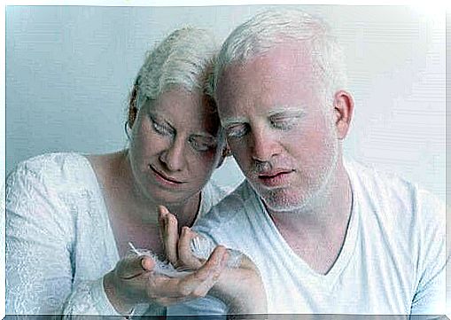 albino woman and man